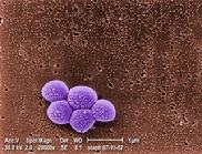 Electron Micrograph of MRSA