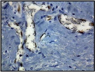 Rabbit Id1 Rabbit Monoclonal clone 195-14